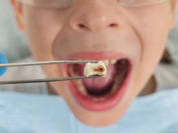 Best Emergency Dental Services for Seniors in Oak View, CA
